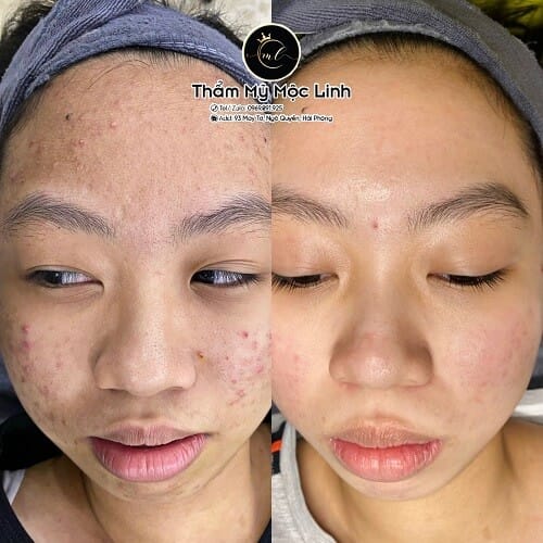 Hình ảnh thực tế tại Thẩm Mỹ Mộc Linh Hải Phòng