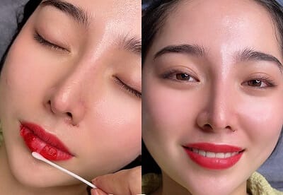Hình ảnh thực tế tại Thẩm Mỹ Mộc Linh Hải Phòng