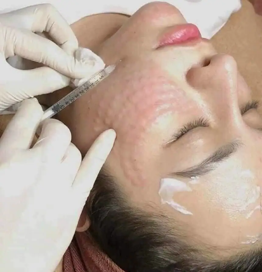 Chăm sóc da chuyên sâu tại Thẩm Mỹ Mộc Linh Hải Phòng