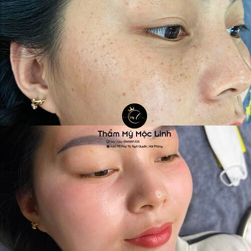 Hình ảnh thực tế tại Thẩm Mỹ Mộc Linh Hải Phòng