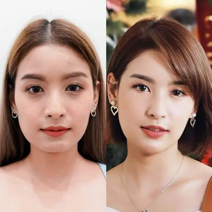 Hình ảnh thực tế tại Thẩm Mỹ Mộc Linh Hải Phòng