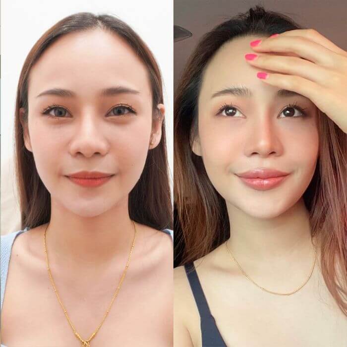 Hình ảnh thực tế tại Thẩm Mỹ Mộc Linh Hải Phòng