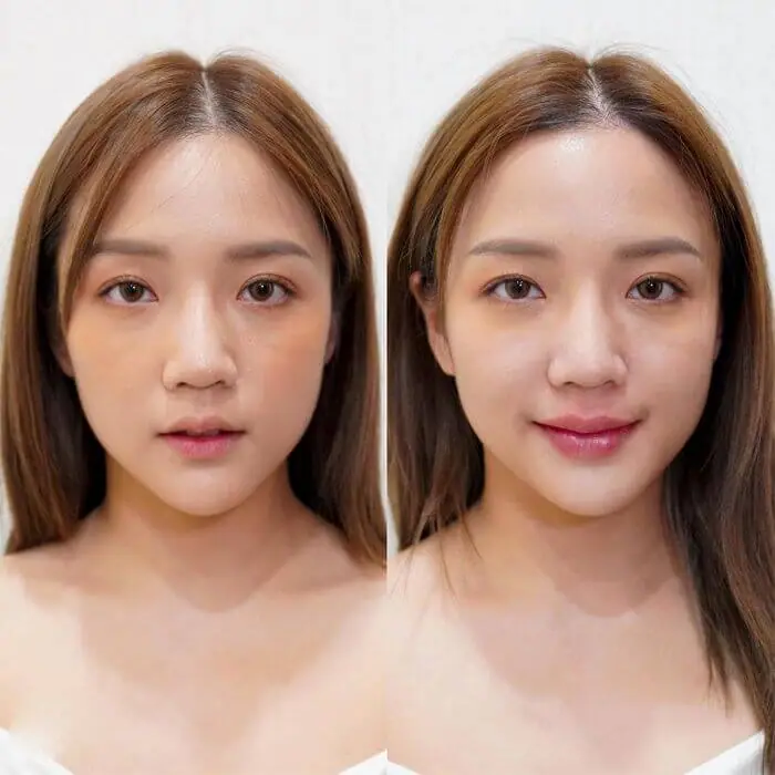 Hình ảnh thực tế tại Thẩm Mỹ Mộc Linh Hải Phòng