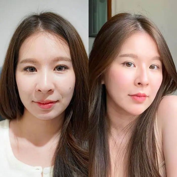 Hình ảnh thực tế tại Thẩm Mỹ Mộc Linh Hải Phòng