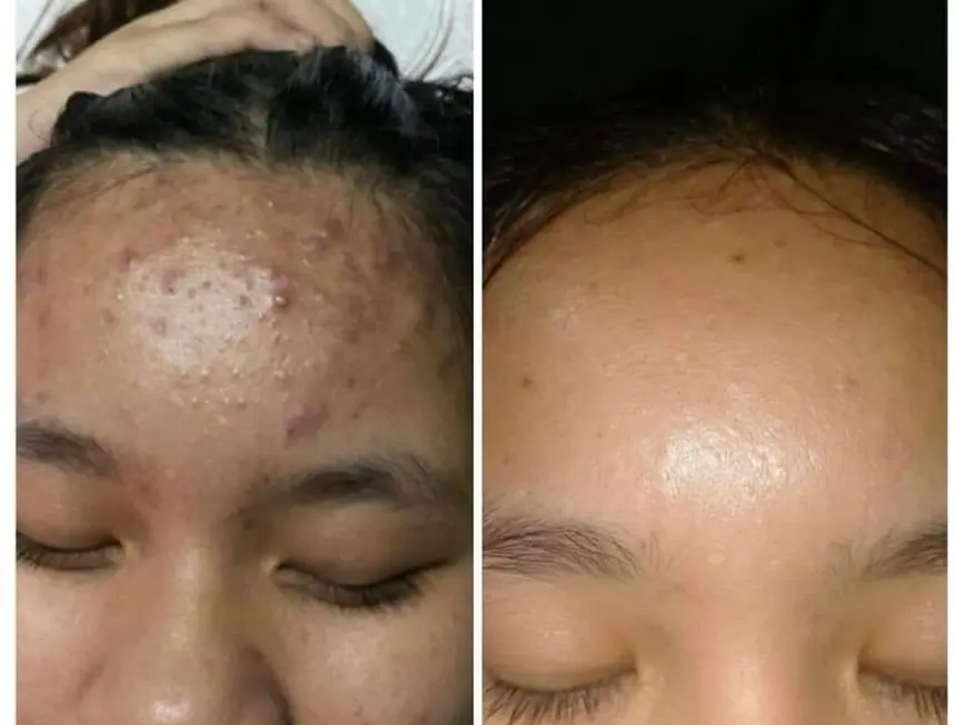Hình ảnh thực tế tại Thẩm Mỹ Mộc Linh Hải Phòng
