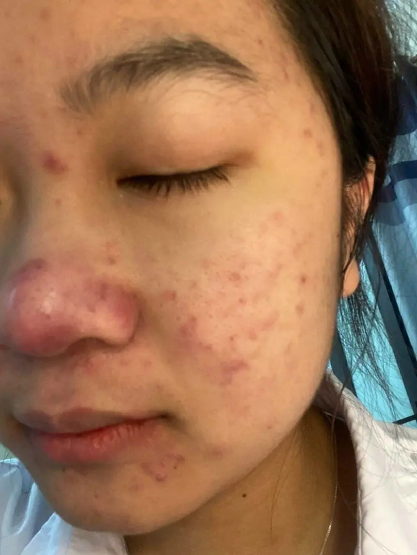 Hình ảnh thực tế tại Thẩm Mỹ Mộc Linh Hải Phòng