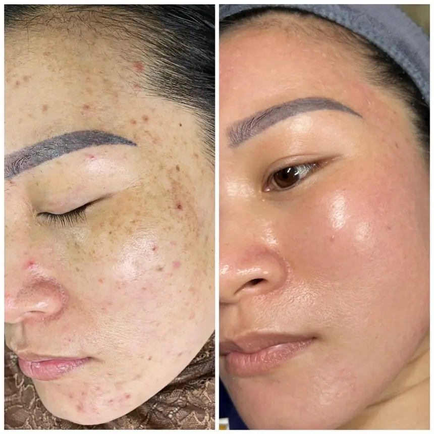 Hình ảnh thực tế tại Thẩm Mỹ Mộc Linh Hải Phòng