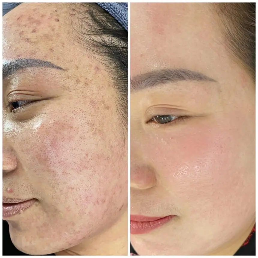 Hình ảnh thực tế tại Thẩm Mỹ Mộc Linh Hải Phòng