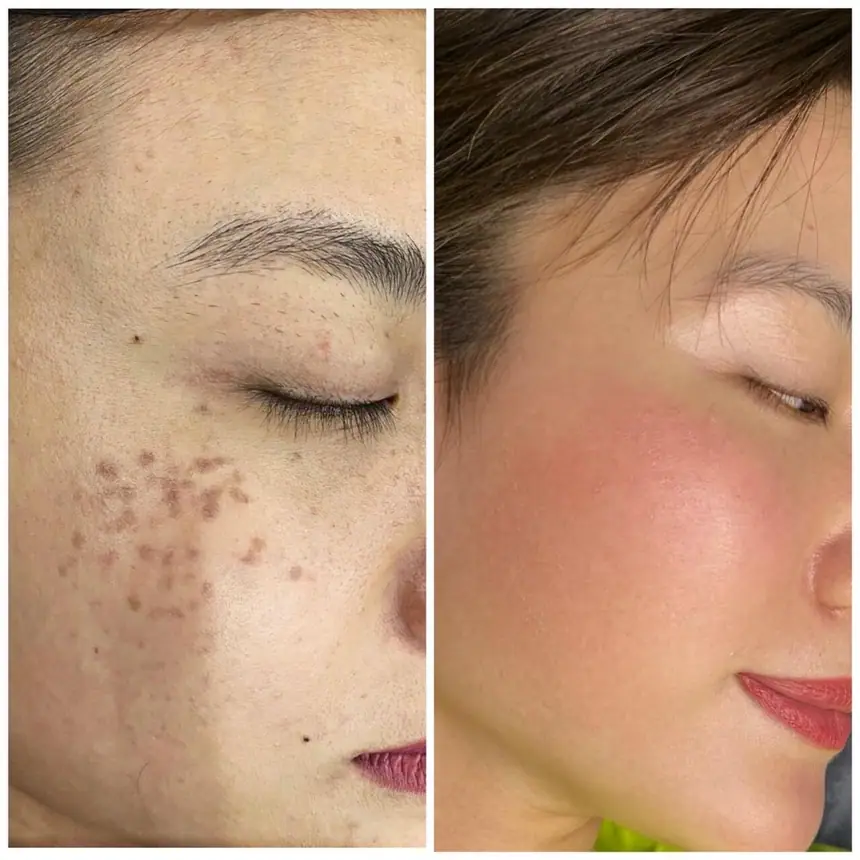 Hình ảnh thực tế tại Thẩm Mỹ Mộc Linh Hải Phòng