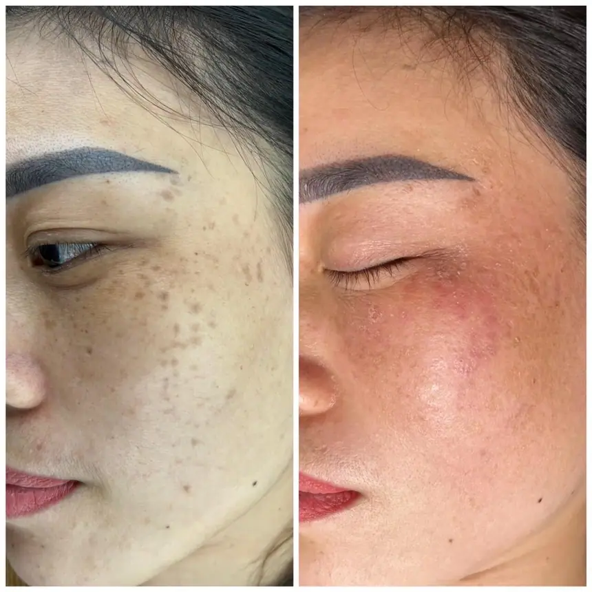Hình ảnh thực tế tại Thẩm Mỹ Mộc Linh Hải Phòng