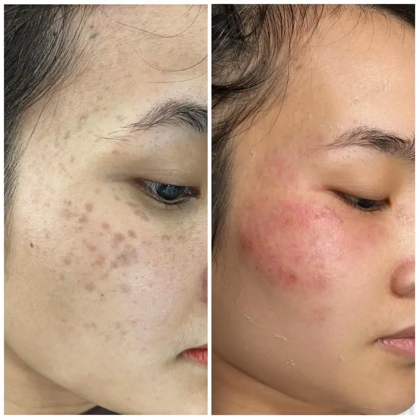 Hình ảnh thực tế tại Thẩm Mỹ Mộc Linh Hải Phòng