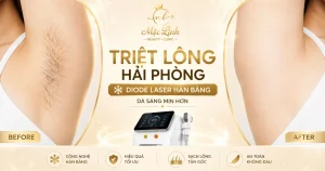 Triệt Lông Hải Phòng tại Thẩm Mỹ Mộc Linh - hình 23