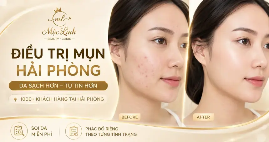Trị Mụn