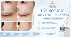 Tẩy nốt ruồi, mụn cơm, mụn thịt tại Thẩm Mỹ Mộc Linh Hải Phòng - hình 35