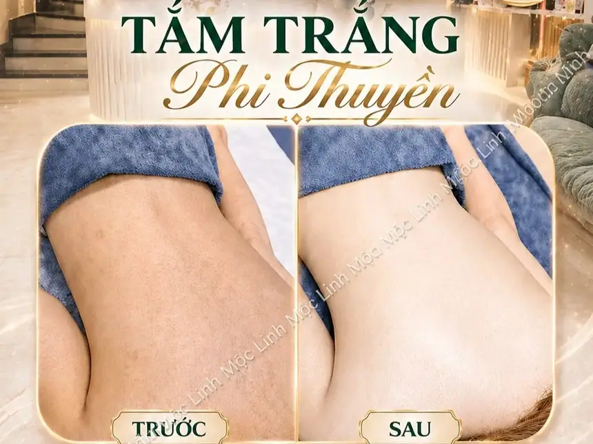 Tắm trắng phi thuyền Hải Phòng tại Thẩm Mỹ Mộc Linh - hình 4