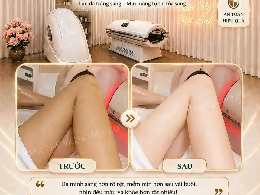 Tắm trắng phi thuyền Hải Phòng tại Thẩm Mỹ Mộc Linh - hình 7