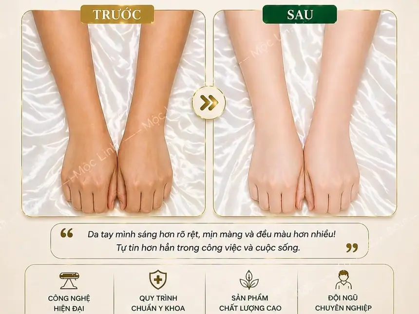 Tắm trắng phi thuyền Hải Phòng tại Thẩm Mỹ Mộc Linh - hình 6