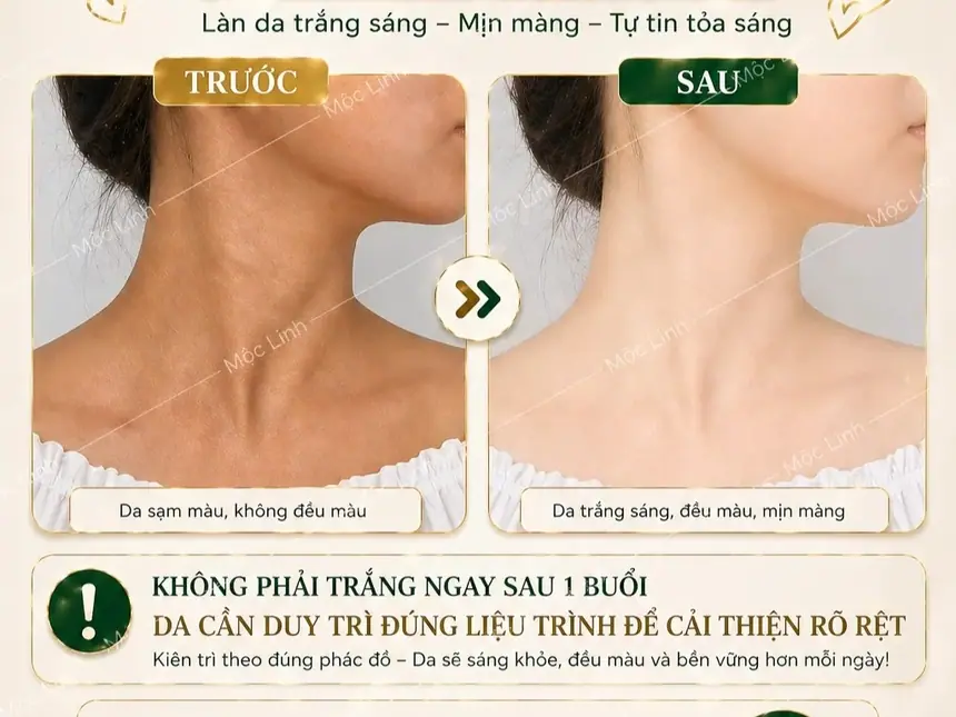 Tắm trắng phi thuyền Hải Phòng tại Thẩm Mỹ Mộc Linh - hình 5