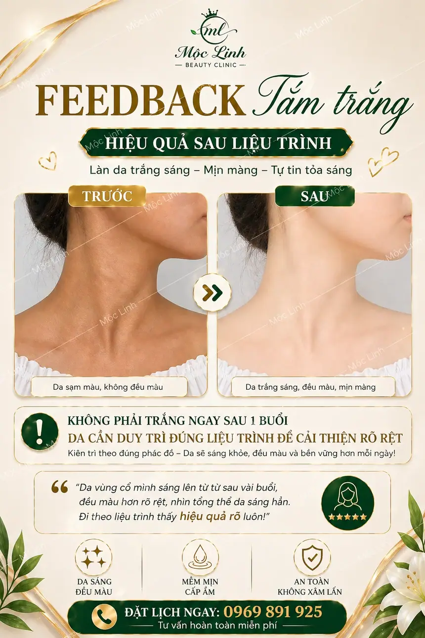 Hình ảnh khách hàng tắm trắng tại Thẩm Mỹ Mộc Linh Hải Phòng