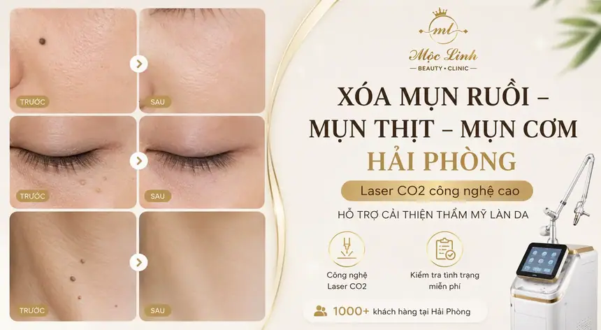 Tẩy nốt ruồi, mụn cơm, mụn thịt tại Thẩm Mỹ Mộc Linh Hải Phòng - hình 1