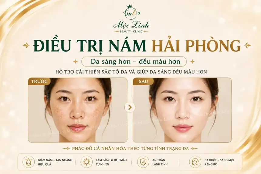 Trị nám/tàn nhang uy tín tại Hải Phòng tại Thẩm Mỹ Mộc Linh - hình 21