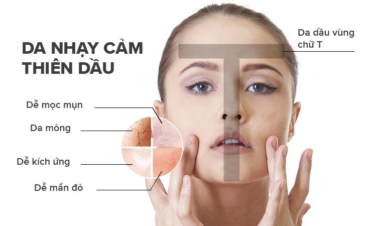 Điều trị da nhờn & lỗ chân lông tại Thẩm Mỹ Mộc Linh Hải Phòng - hình 1