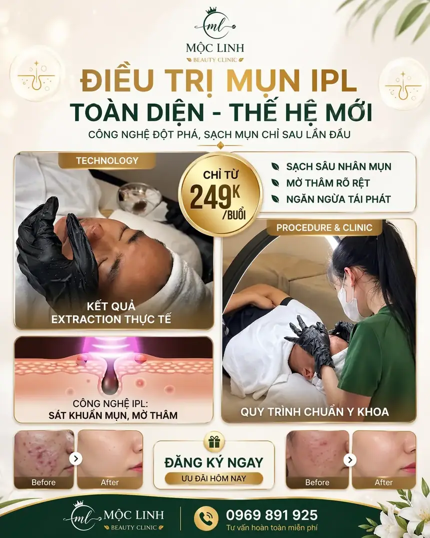 Tư vấn trị mụn tại Thẩm Mỹ Mộc Linh Hải Phòng