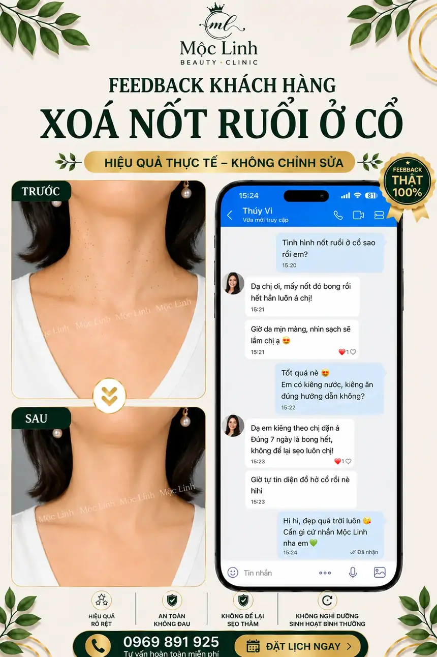 Tẩy nốt ruồi, mụn cơm, mụn thịt tại Thẩm Mỹ Mộc Linh Hải Phòng - hình 8