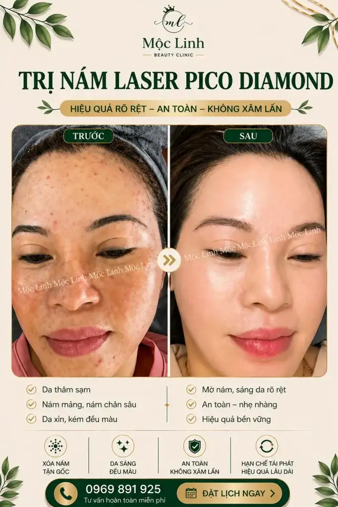 Trị nám/tàn nhang uy tín tại Hải Phòng tại Thẩm Mỹ Mộc Linh - hình 15