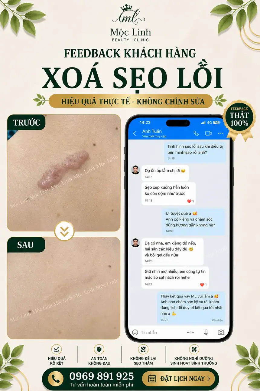 Khách hàng hài lòng sau điều trị sẹo tại Hải Phòng