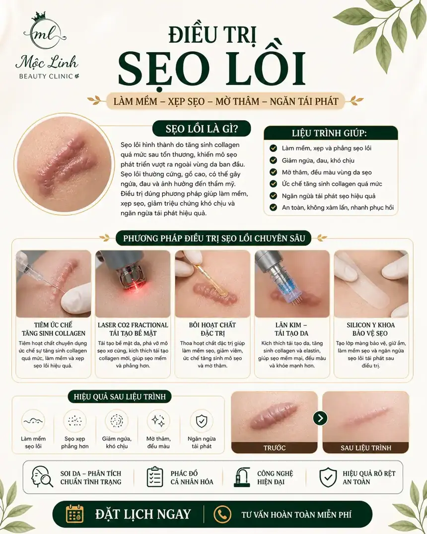 Công nghệ điều trị sẹo hiện đại tại Hải Phòng
