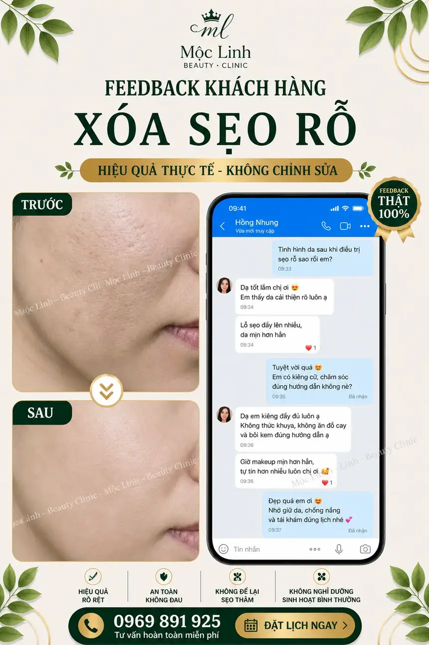 Quy trình điều trị sẹo chuẩn y khoa tại Hải Phòng