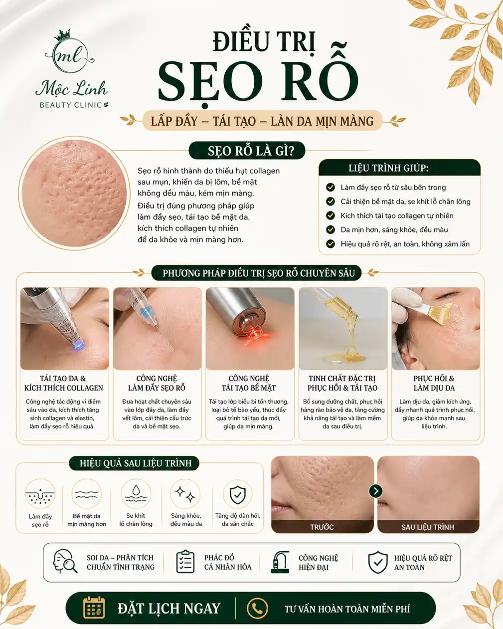 Trước và sau điều trị sẹo rỗ tại Thẩm Mỹ Mộc Linh