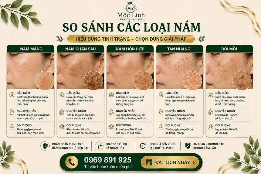 Tư vấn điều trị nám tại Thẩm Mỹ Mộc Linh Hải Phòng