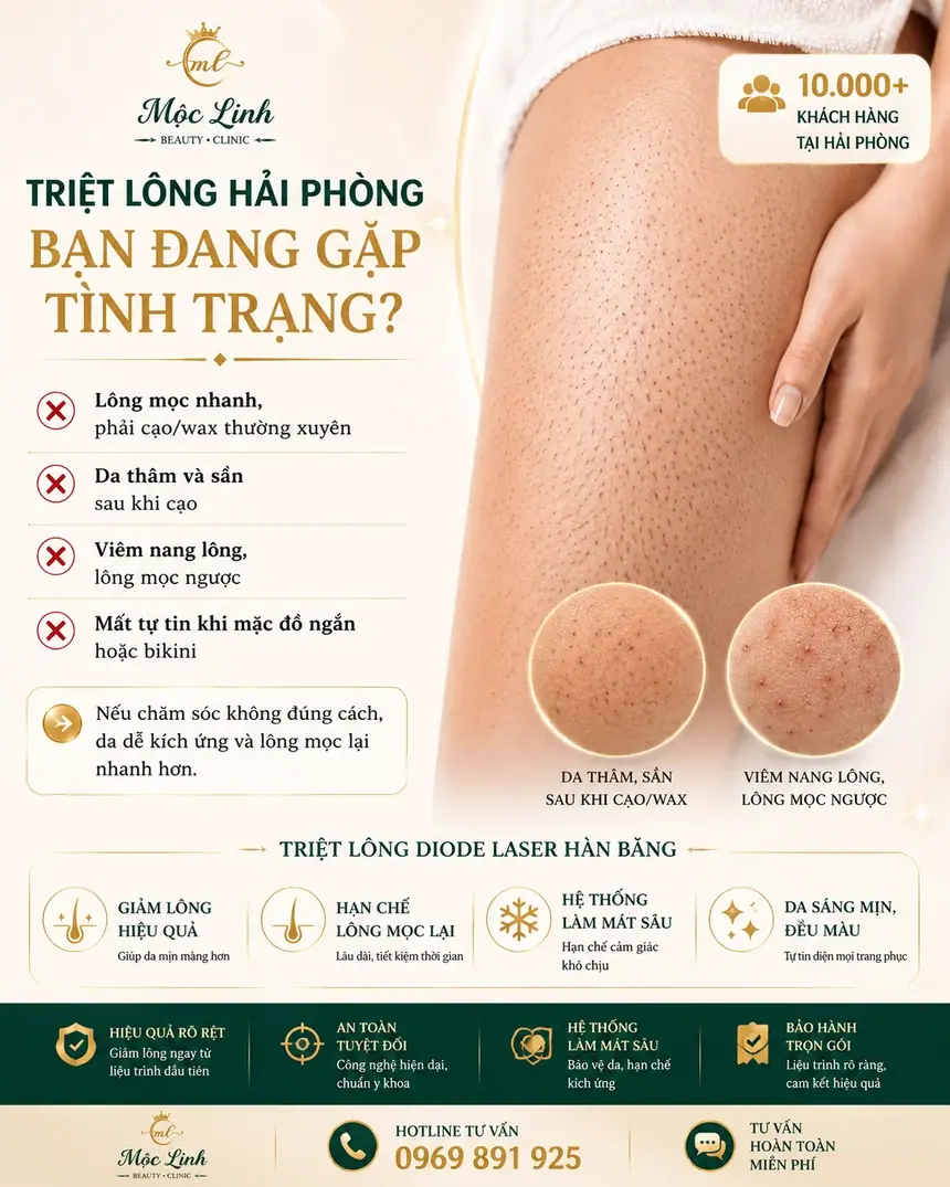Triệt lông công nghệ laser tại Thẩm Mỹ Mộc Linh Hải Phòng