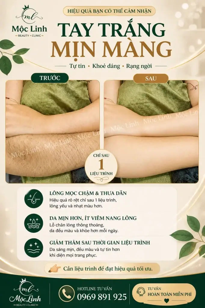 Triệt Lông Hải Phòng tại Thẩm Mỹ Mộc Linh - hình 16