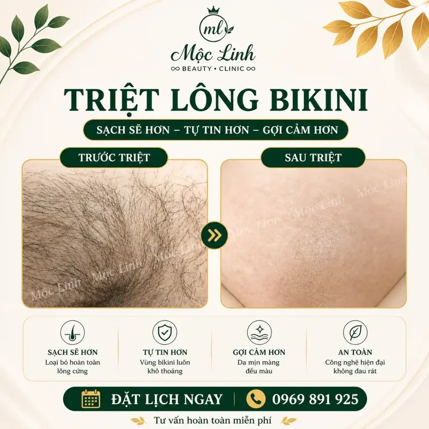 Triệt Lông Hải Phòng tại Thẩm Mỹ Mộc Linh - hình 12