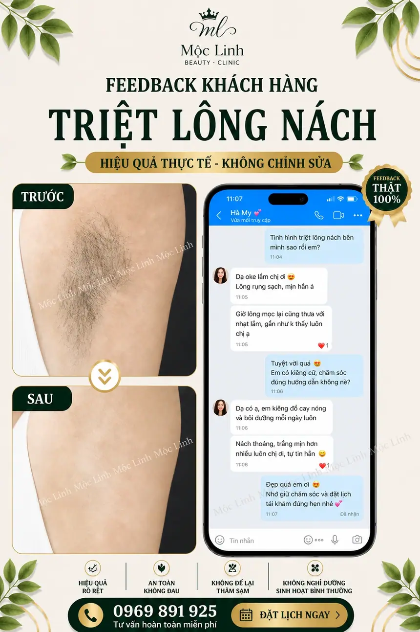 Làn da mịn màng sau triệt lông tại Mộc Linh Hải Phòng