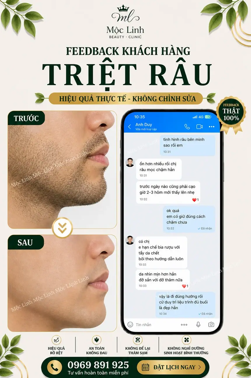 Tư vấn triệt lông cùng chuyên viên Thẩm Mỹ Mộc Linh Hải Phòng