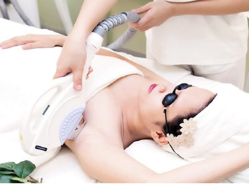 Triệt lông nách tại Thẩm Mỹ Mộc Linh Hải Phòng - hình 4