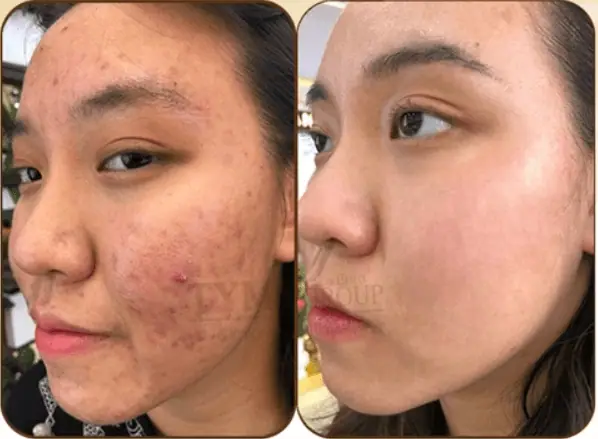 Đào Tạo Điều Trị Da Cơ Bản - Nâng Cao Tại Thẩm Mỹ Viện tại Thẩm Mỹ Mộc Linh Hải Phòng - hình 3