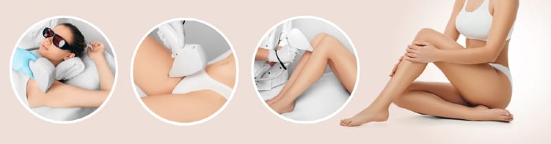 Tận hưởng ngay dịch vụ triệt lông vĩnh viễn bằng công tại Thẩm Mỹ Mộc Linh Hải Phòng - hình 6