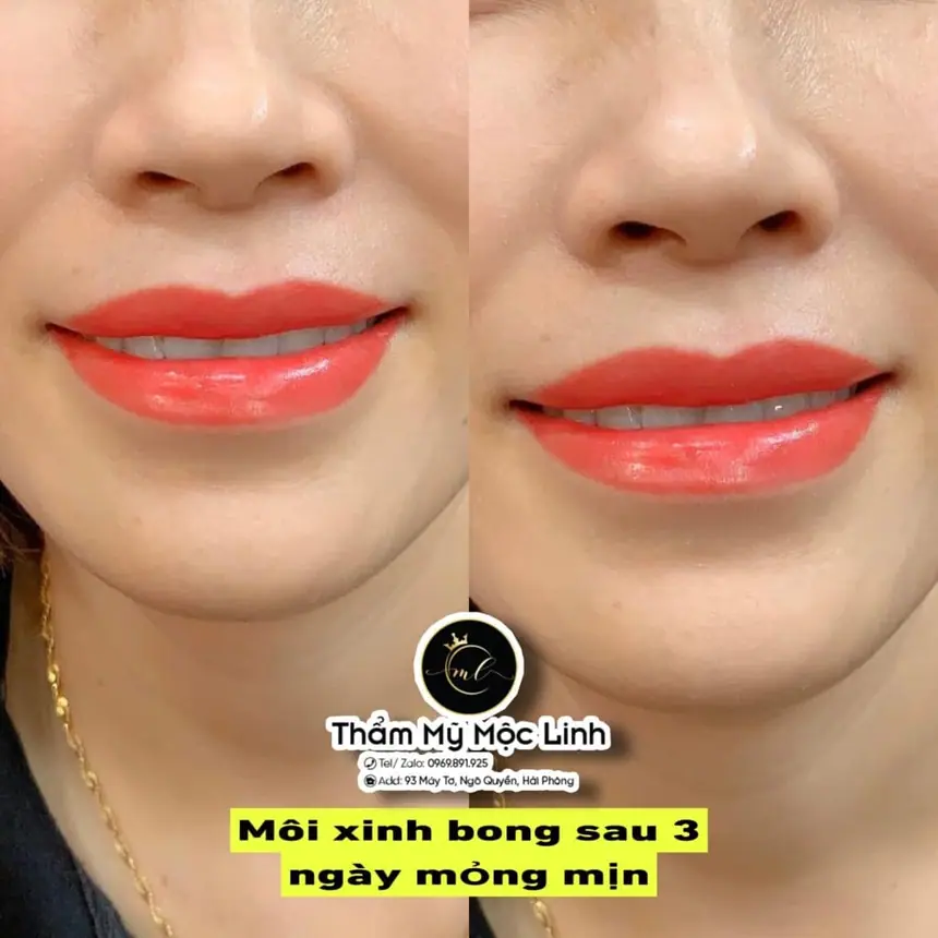 Xăm môi (Phun môi) tại Thẩm Mỹ Mộc Linh Hải Phòng - hình 3
