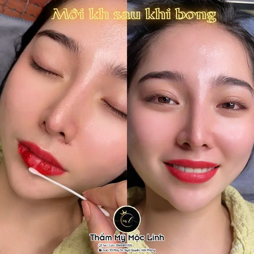 Xăm môi (Phun môi) tại Thẩm Mỹ Mộc Linh Hải Phòng - hình 1