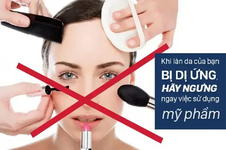 Trị nám, tàn nhang bằng laser cam kết hiệu quả tại Hải tại Thẩm Mỹ Mộc Linh Hải Phòng - hình 2