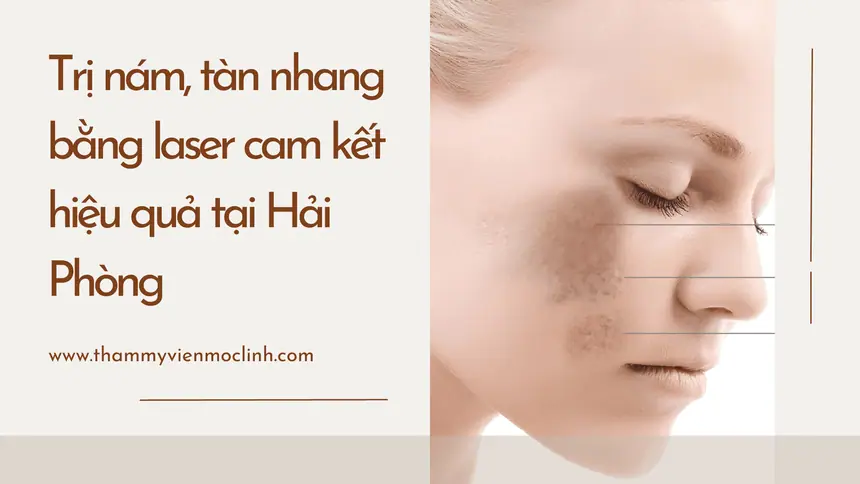 Điều trị nám da Hải Phòng an toàn tại Thẩm Mỹ Mộc Linh