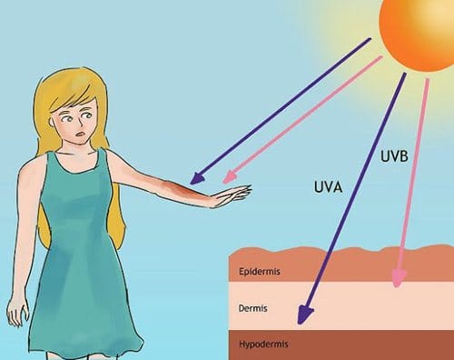 Trị nám, tàn nhang bằng laser cam kết hiệu quả tại Hải tại Thẩm Mỹ Mộc Linh Hải Phòng - hình 1