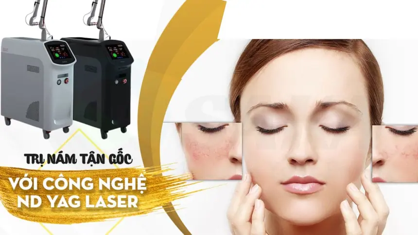 Chuyển giao công nghệ Laser Mụn, Nám, Tàn Nhang, To Lỗ tại Thẩm Mỹ Mộc Linh Hải Phòng - hình 1