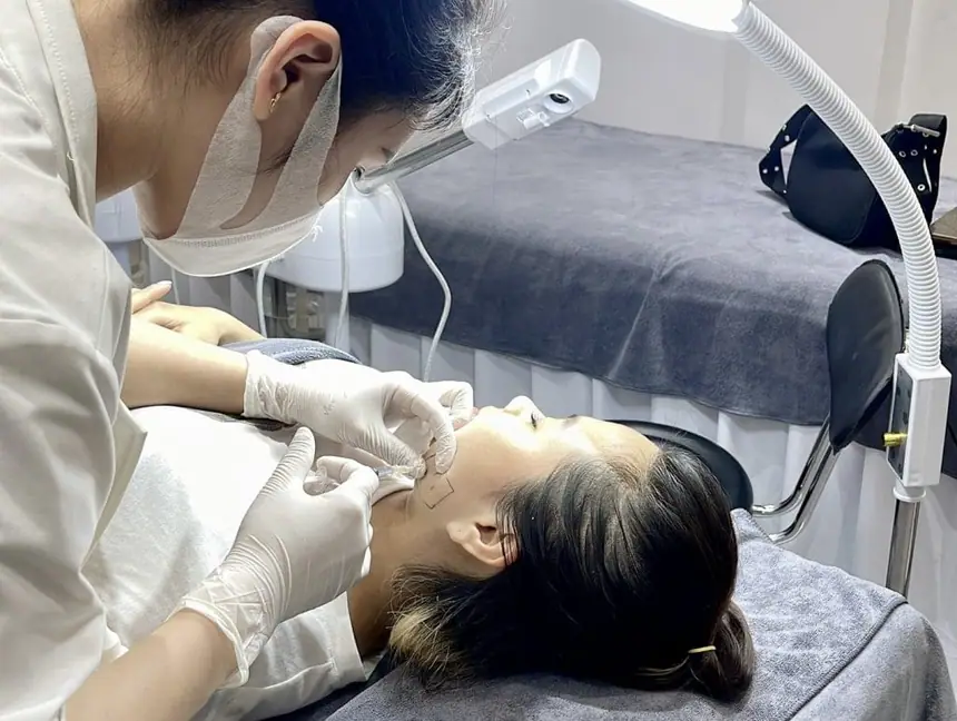 Tiêm Filler An Toàn Uy Tín Hải Phòng tại Thẩm Mỹ Mộc Linh - hình 31