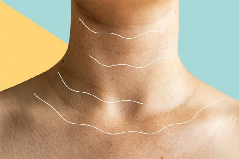 Da cổ bị thâm đen tại Thẩm Mỹ Mộc Linh Hải Phòng - hình 1